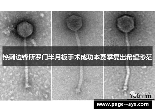 热刺边锋所罗门半月板手术成功本赛季复出希望渺茫 热刺边锋所罗门半月板手术成功本赛季复出希望渺茫